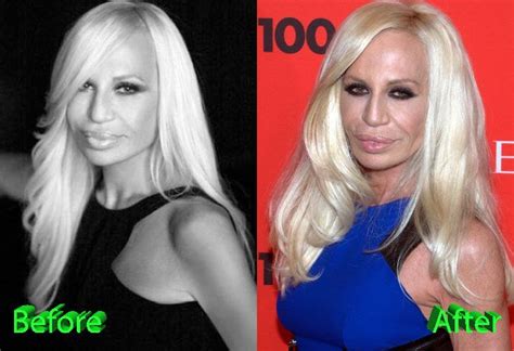 donatella versace riabilitazione|donatella versace hair.